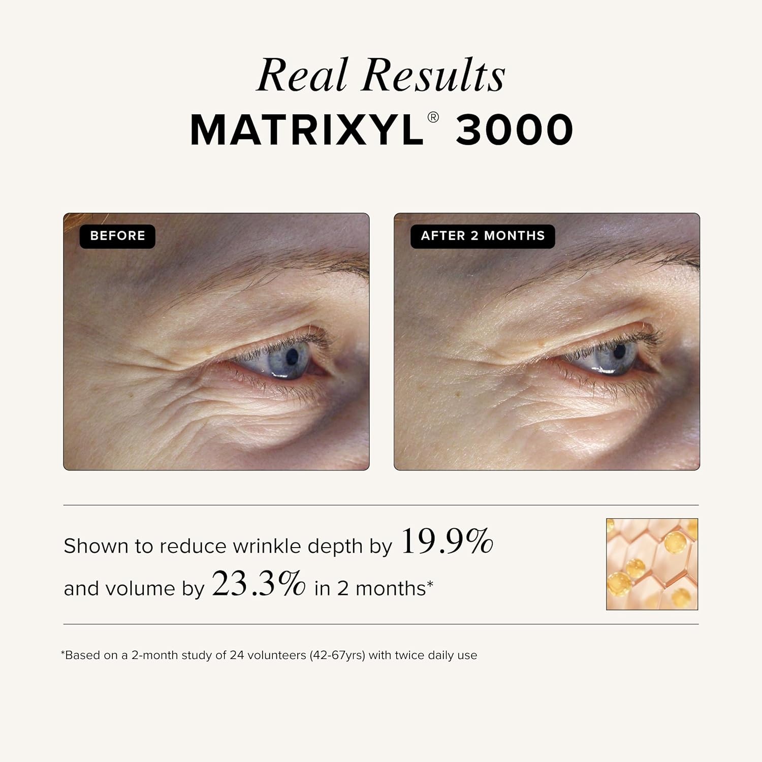 image:imageAsterwood Matrixyl 3000 Argireline Serum for Face Multi Peptide Serum with Hyaluronic Acid AntiAging Wrinkle Reducing Collagen Boosting FragranceFree 8 Fl Oz4 Fl Oz Pack of 1