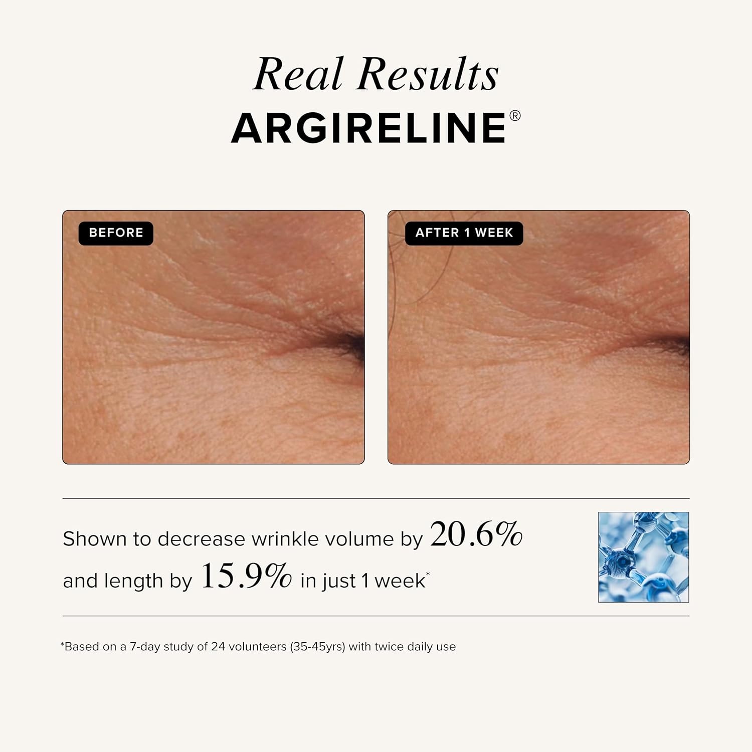 image:imageAsterwood Matrixyl 3000 Argireline Serum for Face Multi Peptide Serum with Hyaluronic Acid AntiAging Wrinkle Reducing Collagen Boosting FragranceFree 8 Fl Oz4 Fl Oz Pack of 1