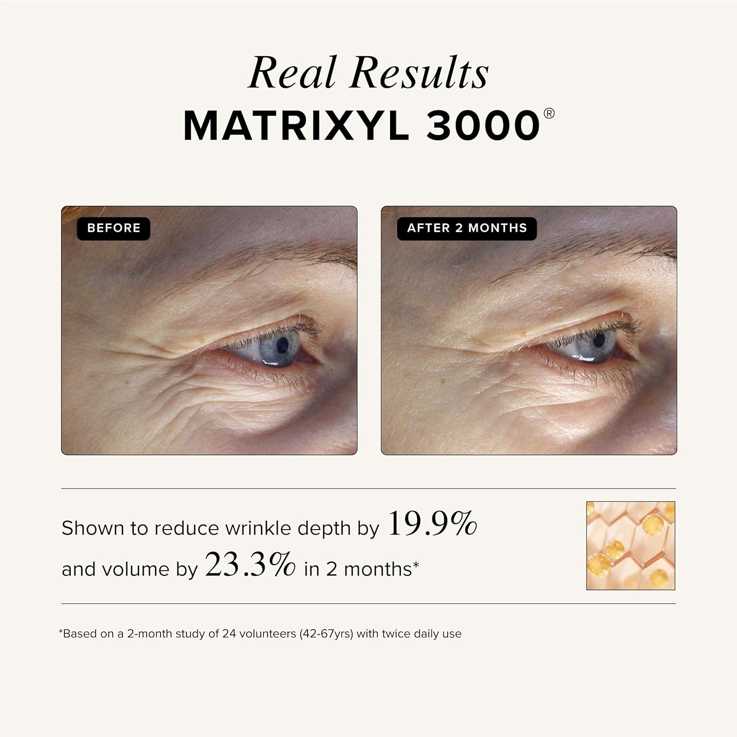 image:imageAsterwood Triple Repair Matrixyl 3000 Argireline Hyaluronic Acid Vitamin C Serum for Face AntiAging Collagen Boosting Hydrating FragranceFree 8 Fl OzTriple Repair