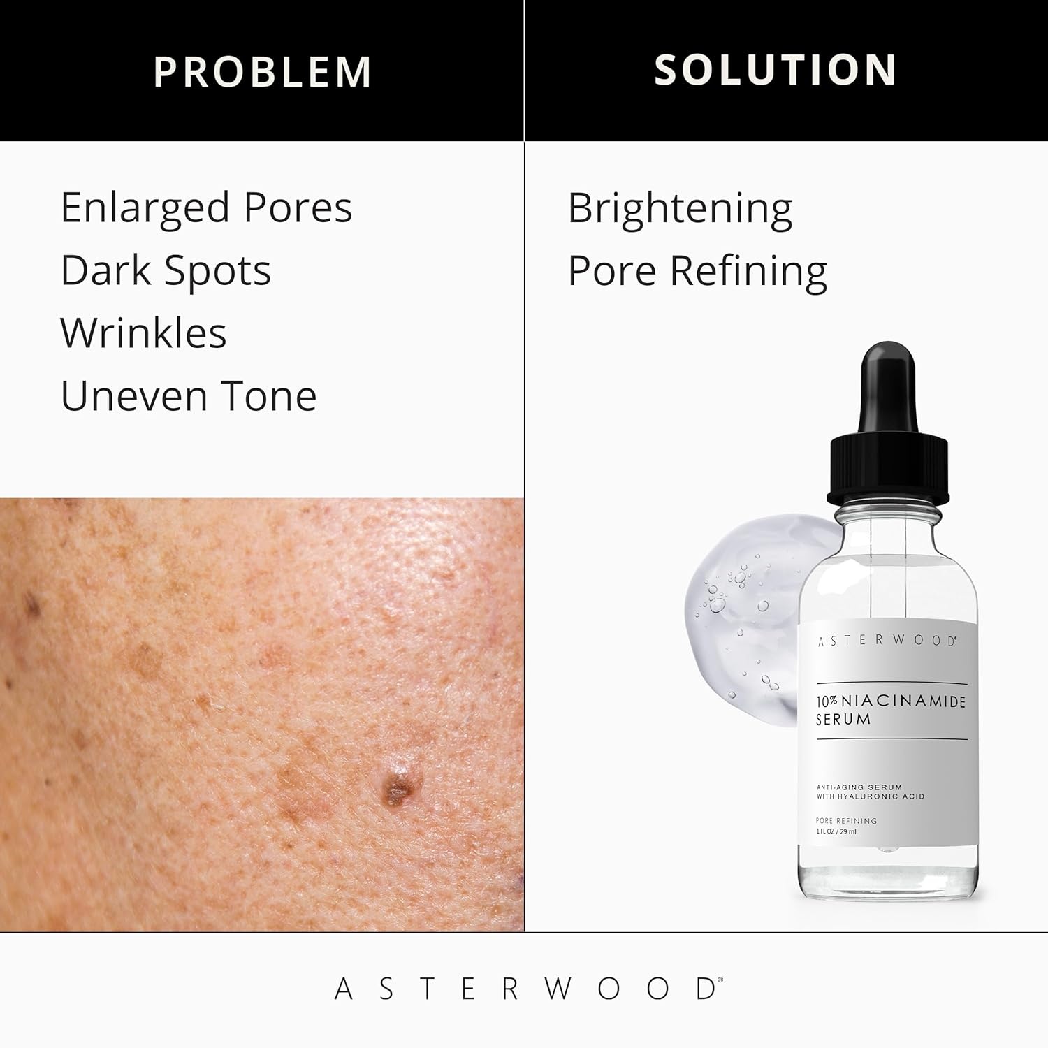 image:imageAsterwood 10 Niacinamide Serum for Face AntiAging Pore Minimizing Hydrating with Vitamin B3 and Hyaluronic Acid Tone Texture FragranceFree 1 Fl Oz