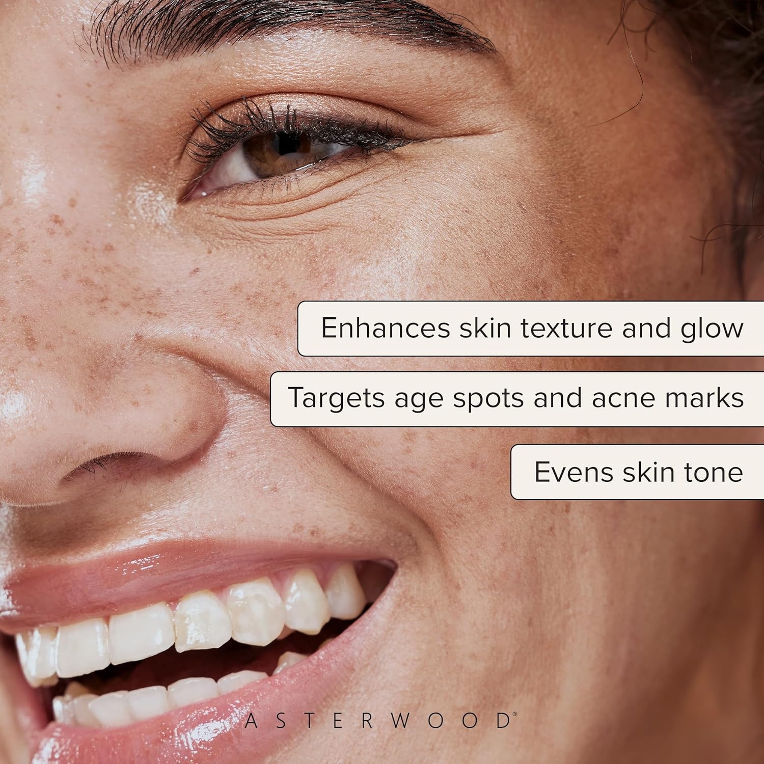 image:imageAsterwood Dark Spot Corrector for Face Serum with Radianskin with Tranexamic Acid Kojic Acid Glycolic Acid amp Salicylic Acid 1 Fl Oz